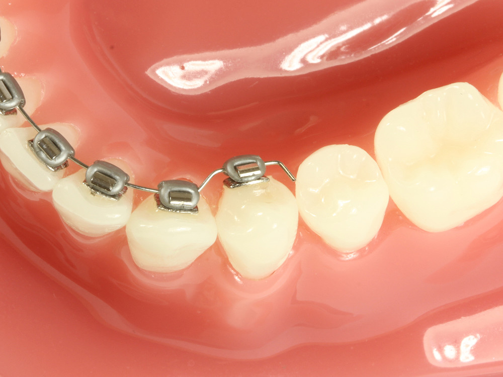 Cinch Back Hammerhead IX953