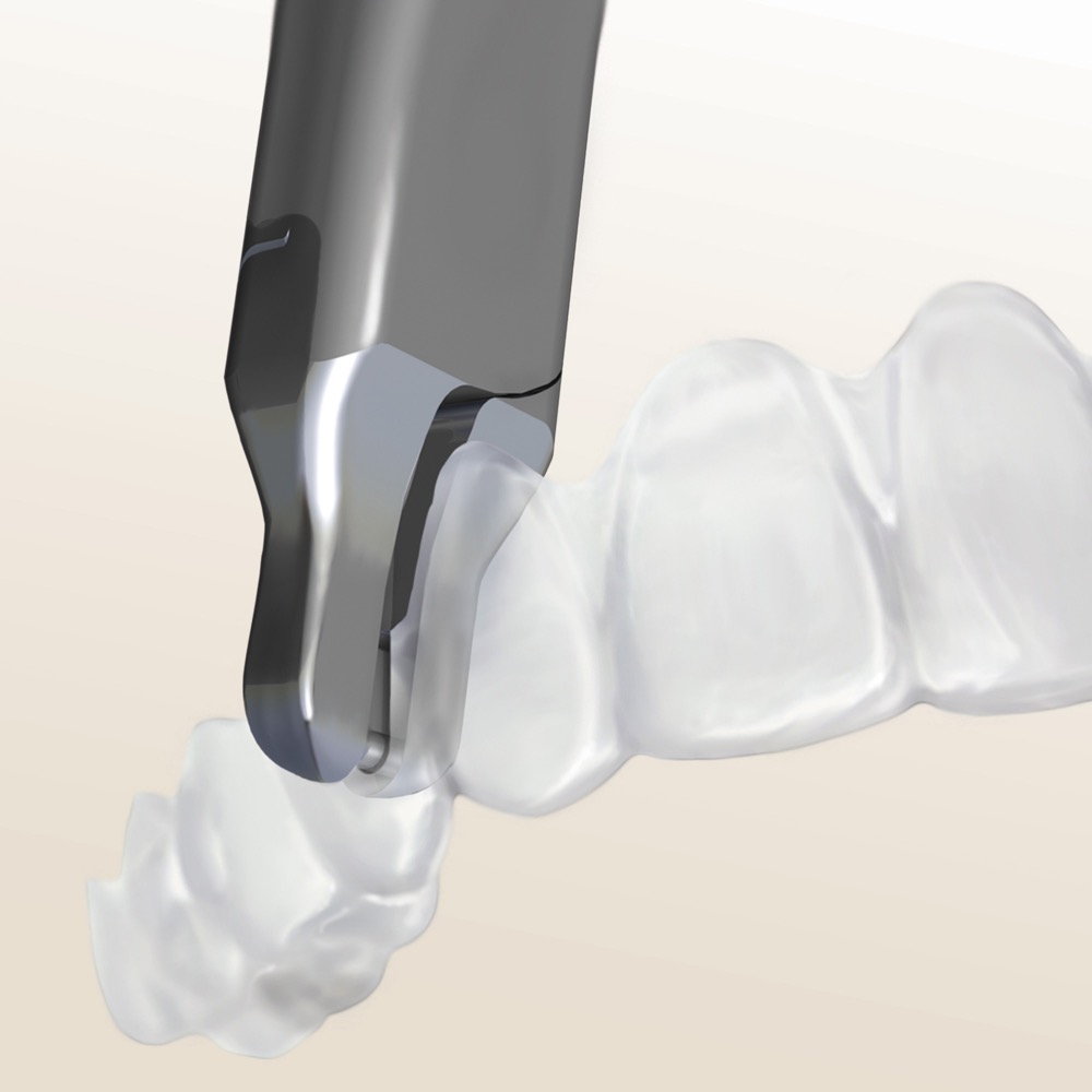 Tear Drop Aligner Zange 678-800
