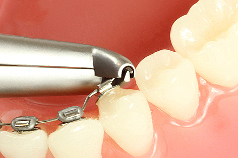 Cinch Back Hammerhead IX953